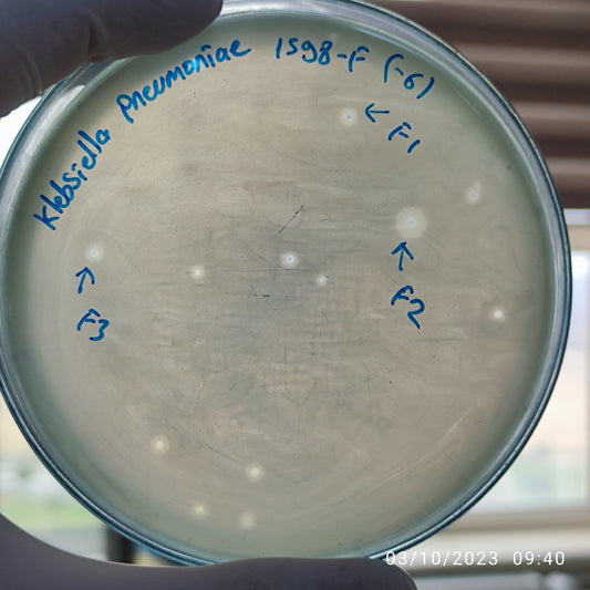 Klebsiella pneumoniae bacteriophage 181598F