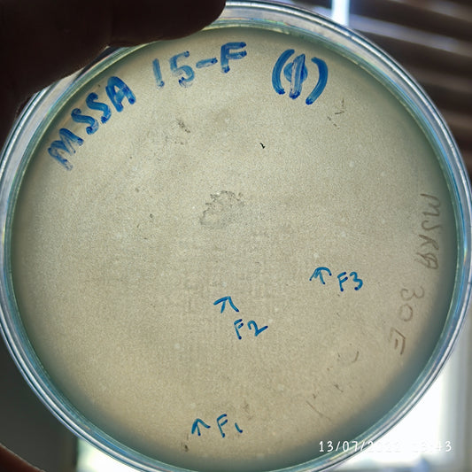 Staphylococcus aureus bacteriophage 152015F