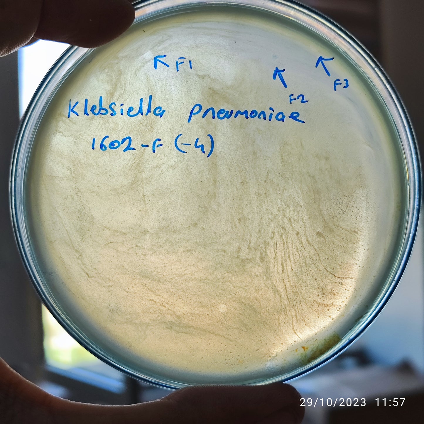 Klebsiella pneumoniae bacteriophage 181602F