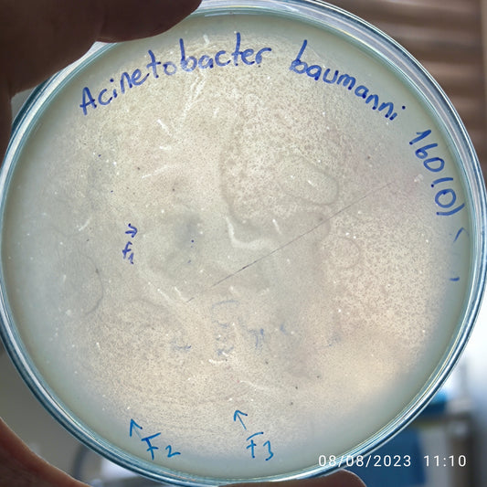 Acinetobacter baumannii bacteriophage 120160F