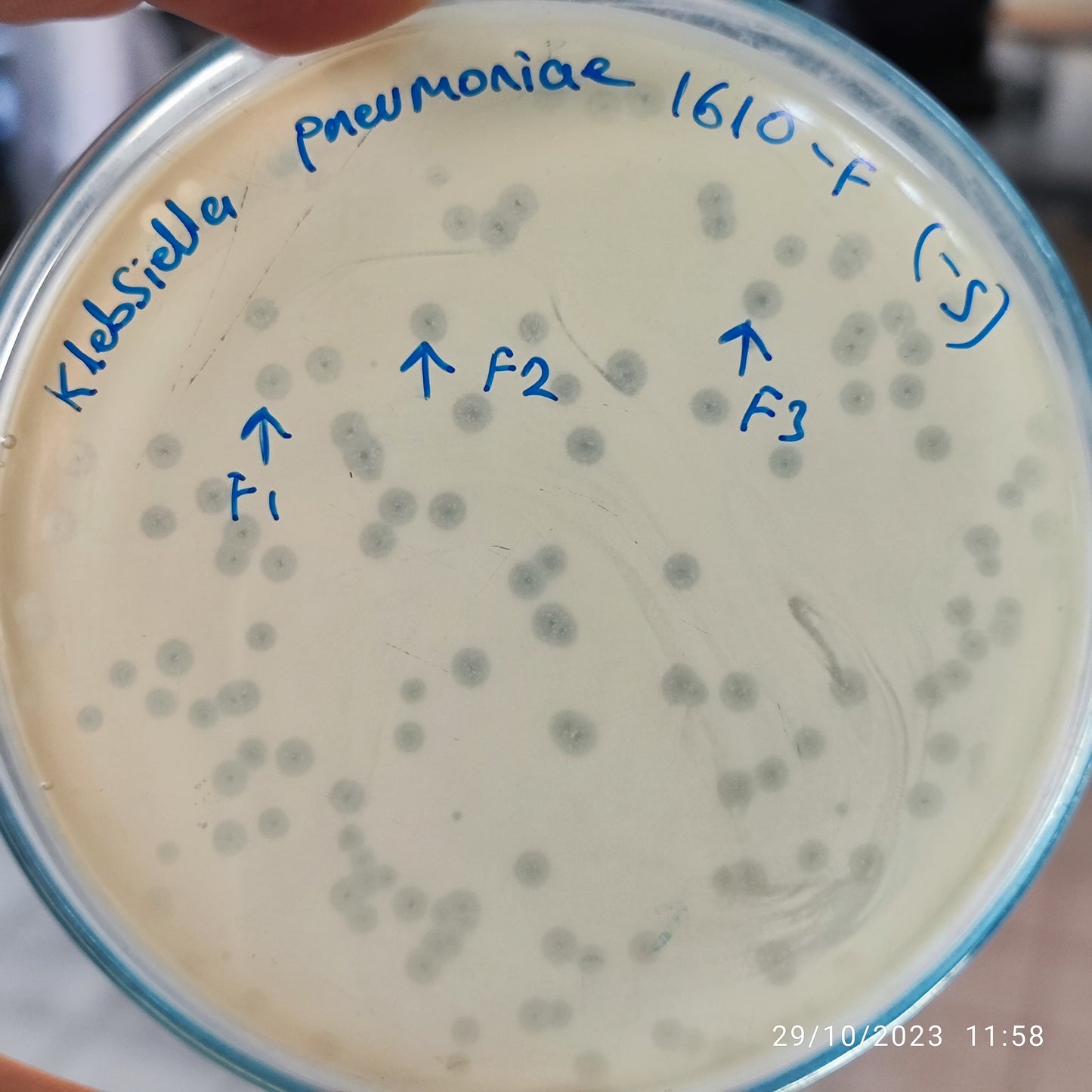 Klebsiella pneumoniae bacteriophage 181610F