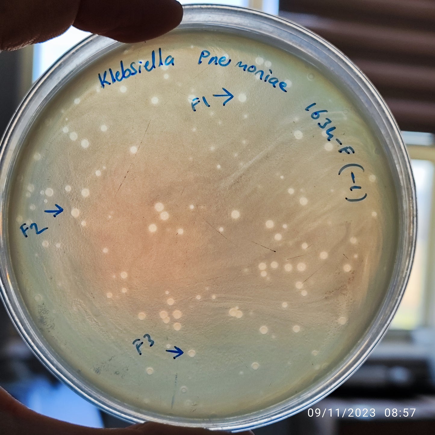 Klebsiella pneumoniae bacteriophage 181634F