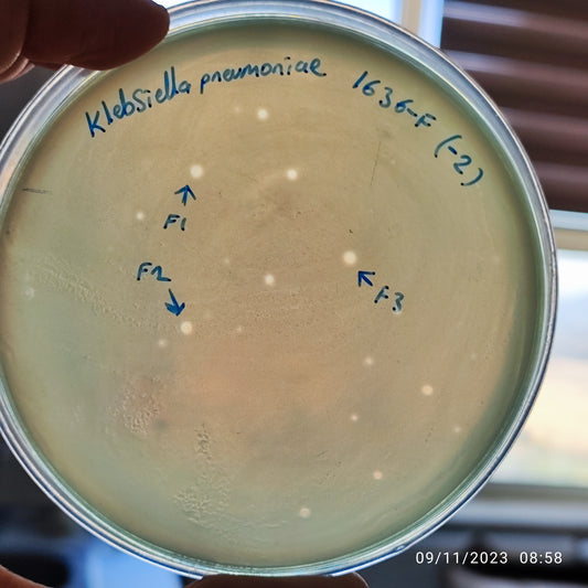 Klebsiella pneumoniae bacteriophage 181636F