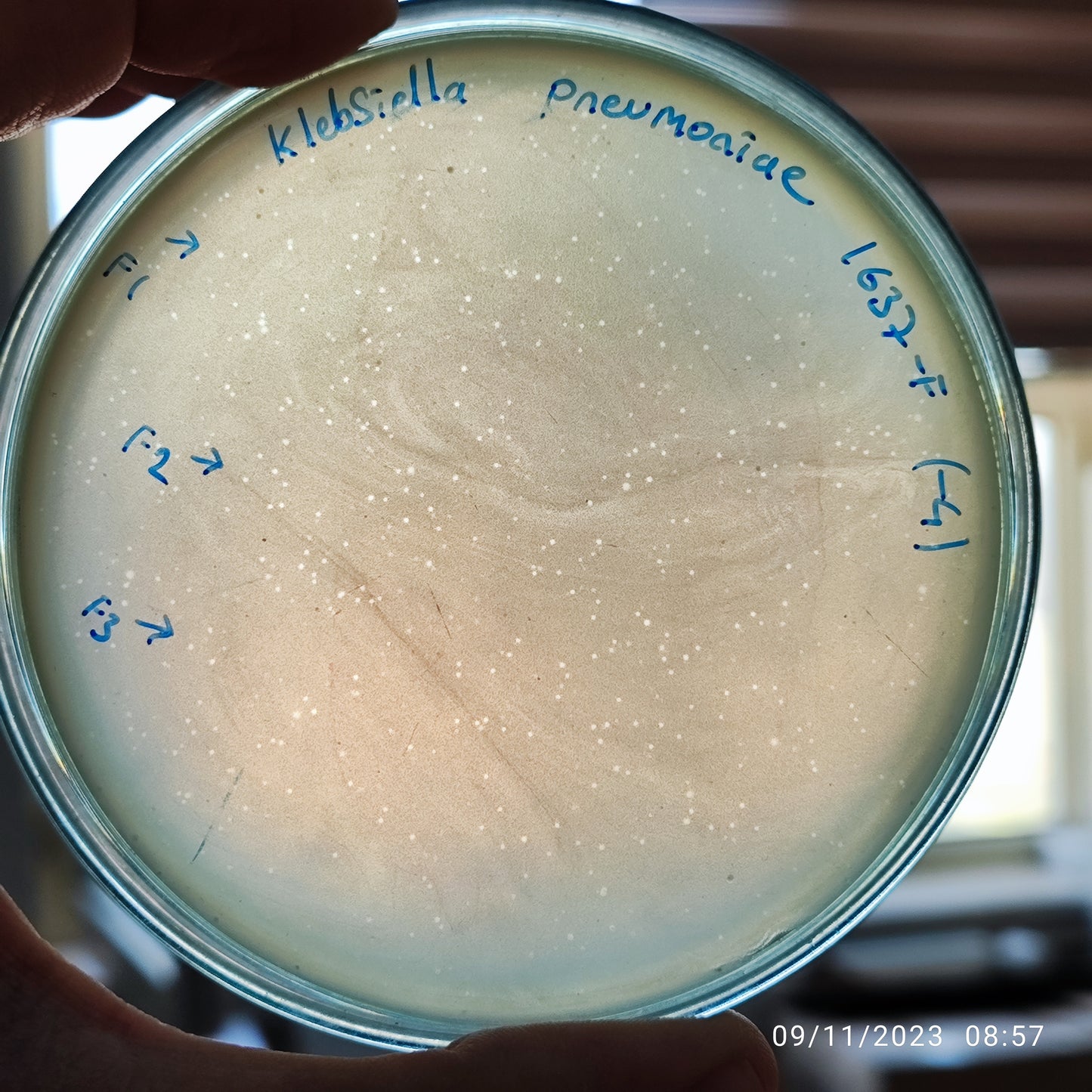 Klebsiella pneumoniae bacteriophage 181637F