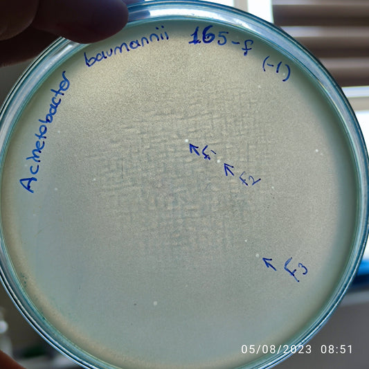 Acinetobacter baumannii bacteriophage 120165F