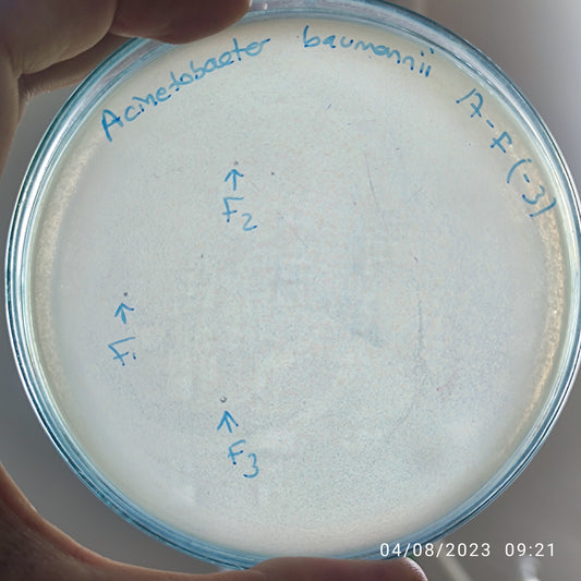 Acinetobacter baumannii bacteriophage 120017F