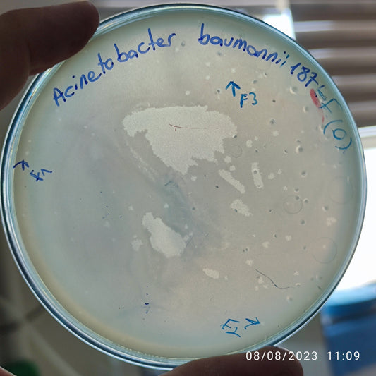 Acinetobacter baumannii bacteriophage 120187F