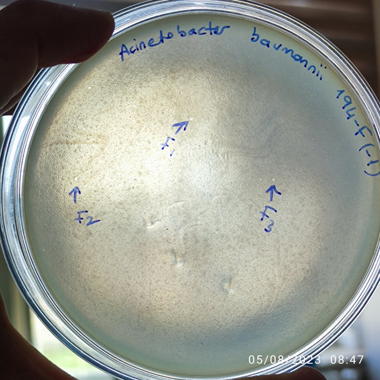 Acinetobacter baumannii bacteriophage 120194F