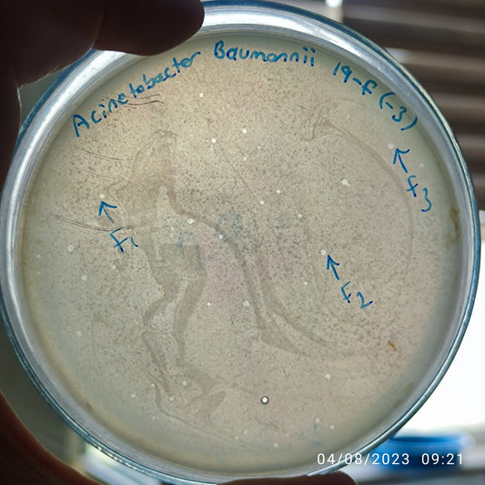 Acinetobacter baumannii bacteriophage 120019F