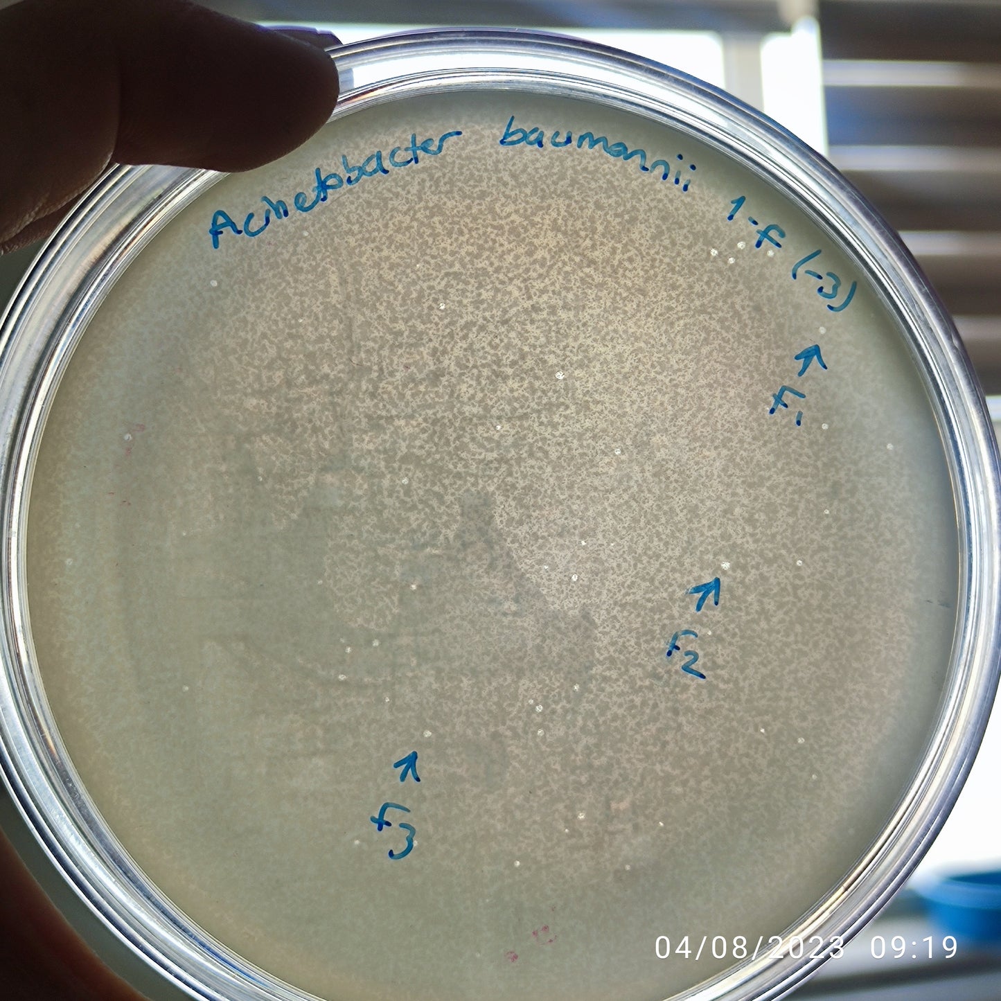 Acinetobacter baumannii bacteriophage 120001F