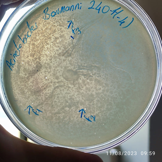 Acinetobacter baumannii bacteriophage 120204F