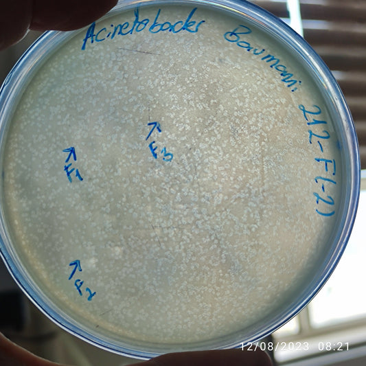 Acinetobacter baumannii bacteriophage 120212F