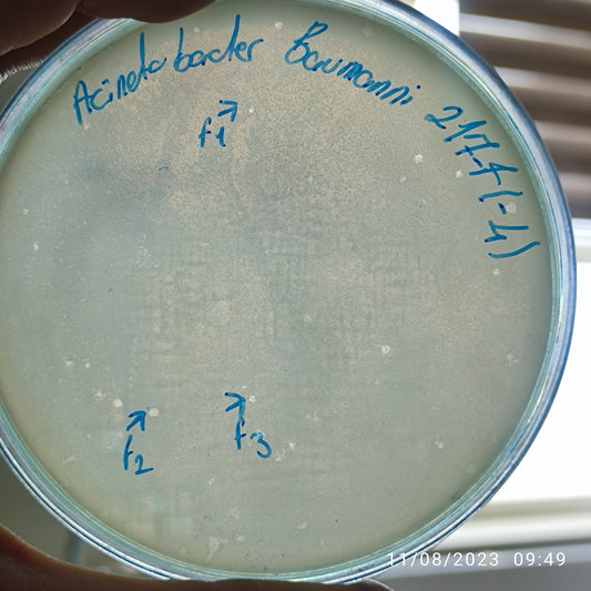 Acinetobacter baumannii bacteriophage 120217F