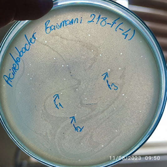 Acinetobacter baumannii bacteriophage 120218F