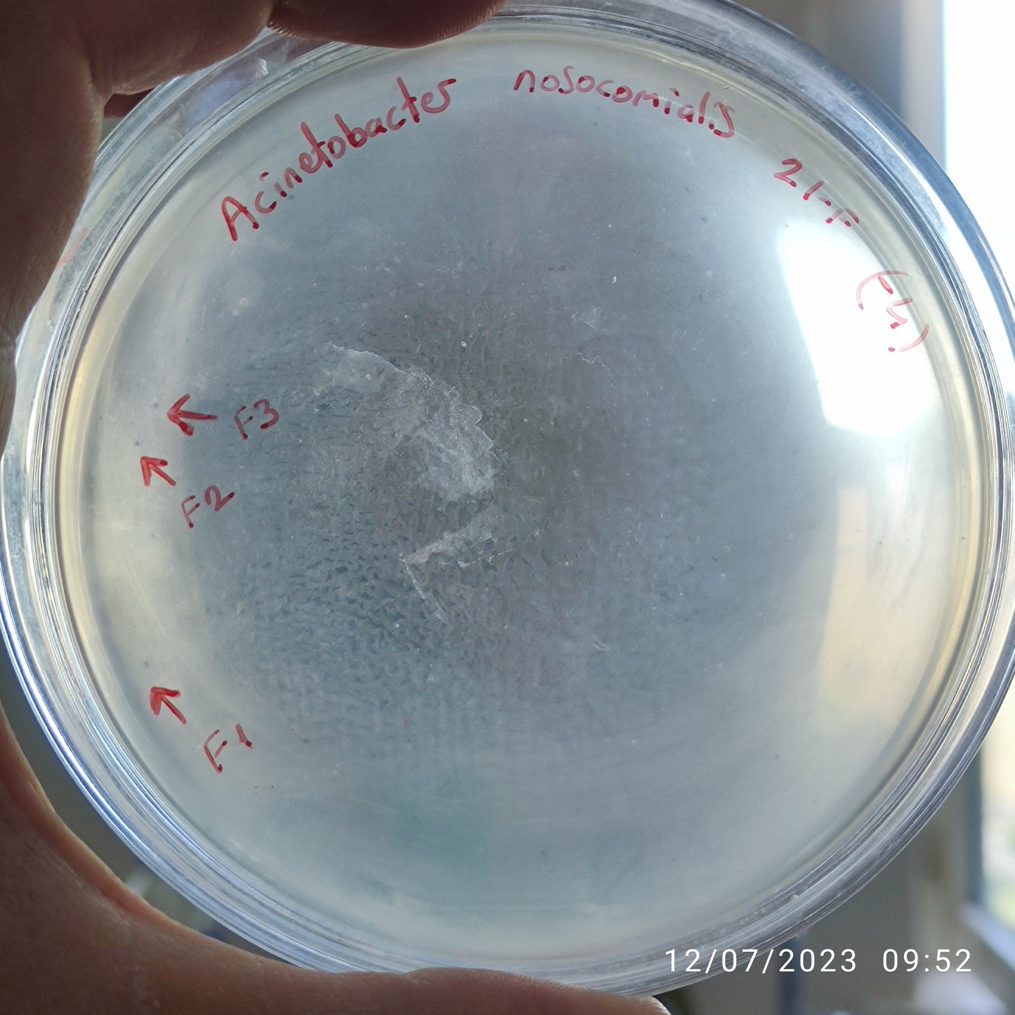 Acinetobacter nosocomialis bacteriophage 128021F