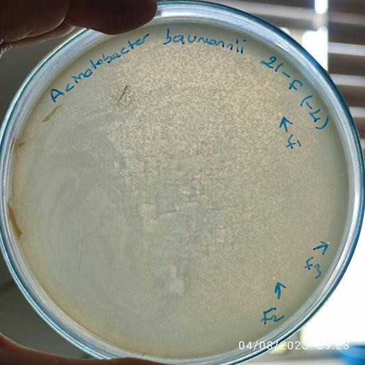 Acinetobacter baumannii bacteriophage 120021F