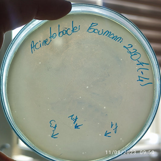 Acinetobacter baumannii bacteriophage 120220F