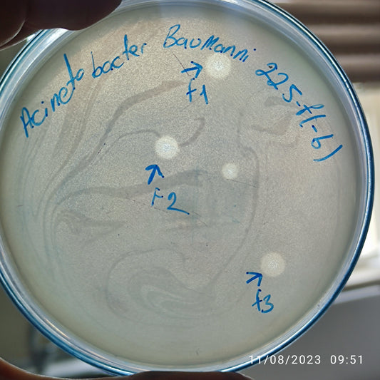 Acinetobacter baumannii bacteriophage 120225F