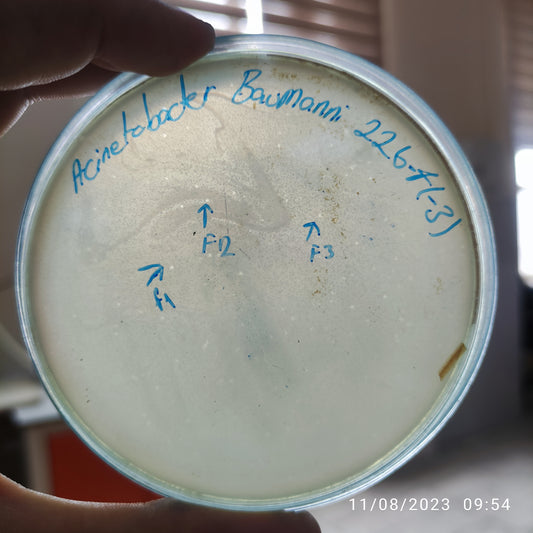 Acinetobacter baumannii bacteriophage 120226F