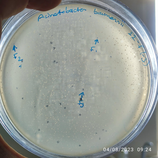Acinetobacter baumannii bacteriophage 120022F