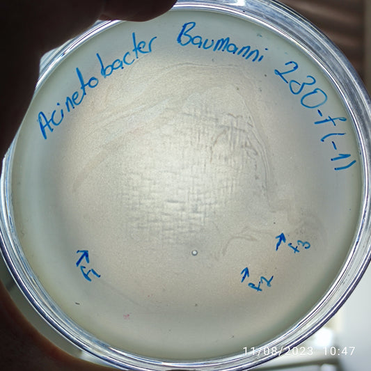 Acinetobacter baumannii bacteriophage 120230F