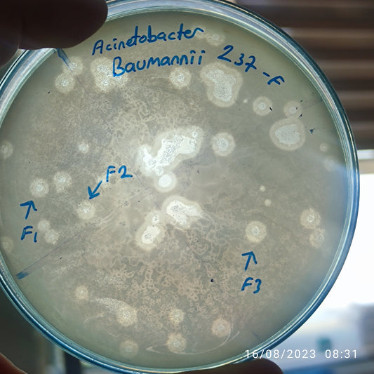 Acinetobacter baumannii bacteriophage 120237F
