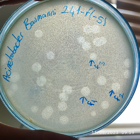Acinetobacter baumannii bacteriophage 120241F
