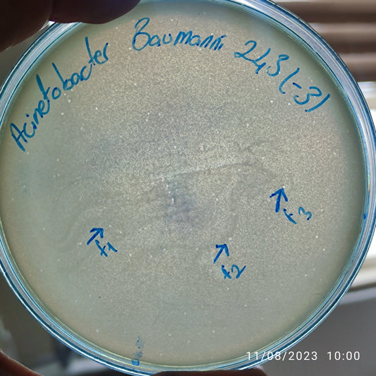 Acinetobacter baumannii bacteriophage 120243F