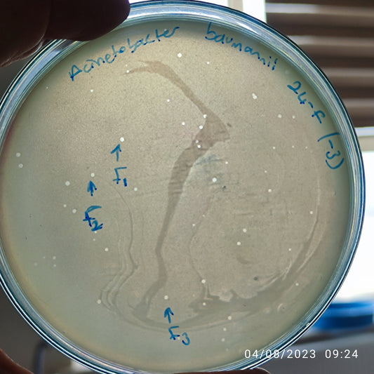 Acinetobacter baumannii bacteriophage 120024F
