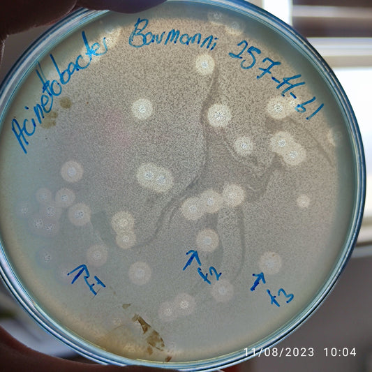 Acinetobacter baumannii bacteriophage 120257F