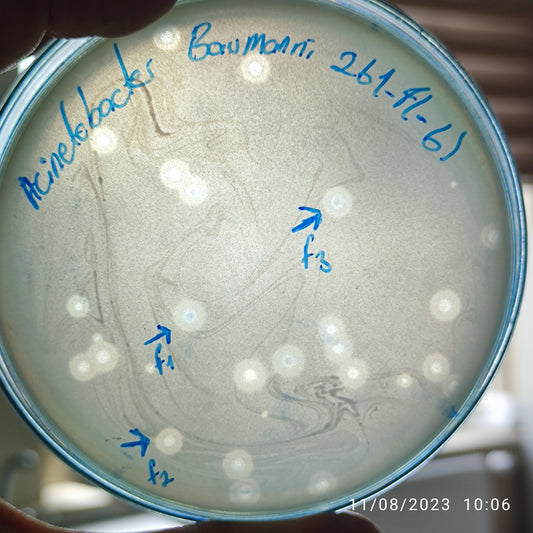 Acinetobacter baumannii bacteriophage 120261F