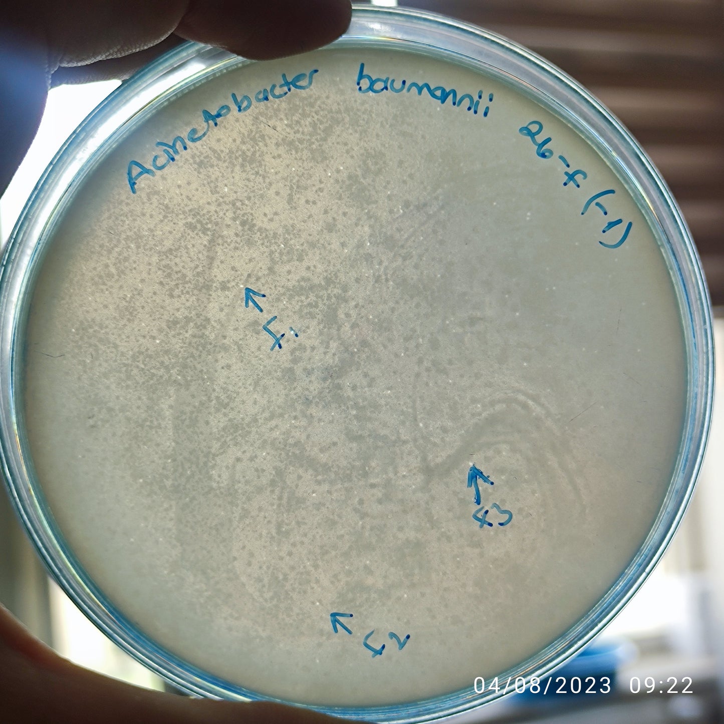Acinetobacter baumannii bacteriophage 120026F