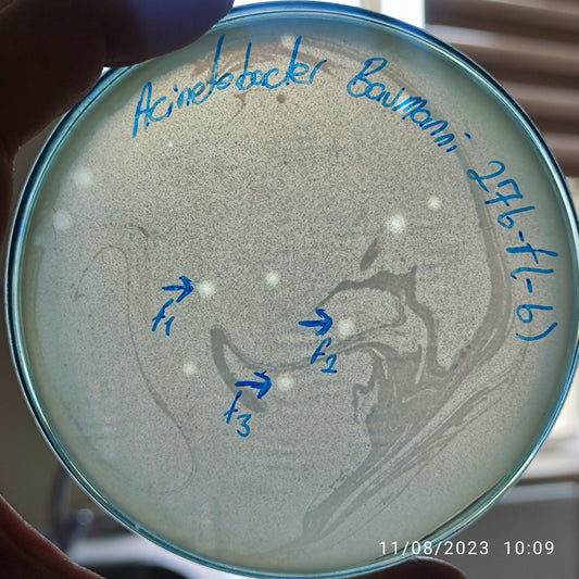 Acinetobacter baumannii bacteriophage 120276F