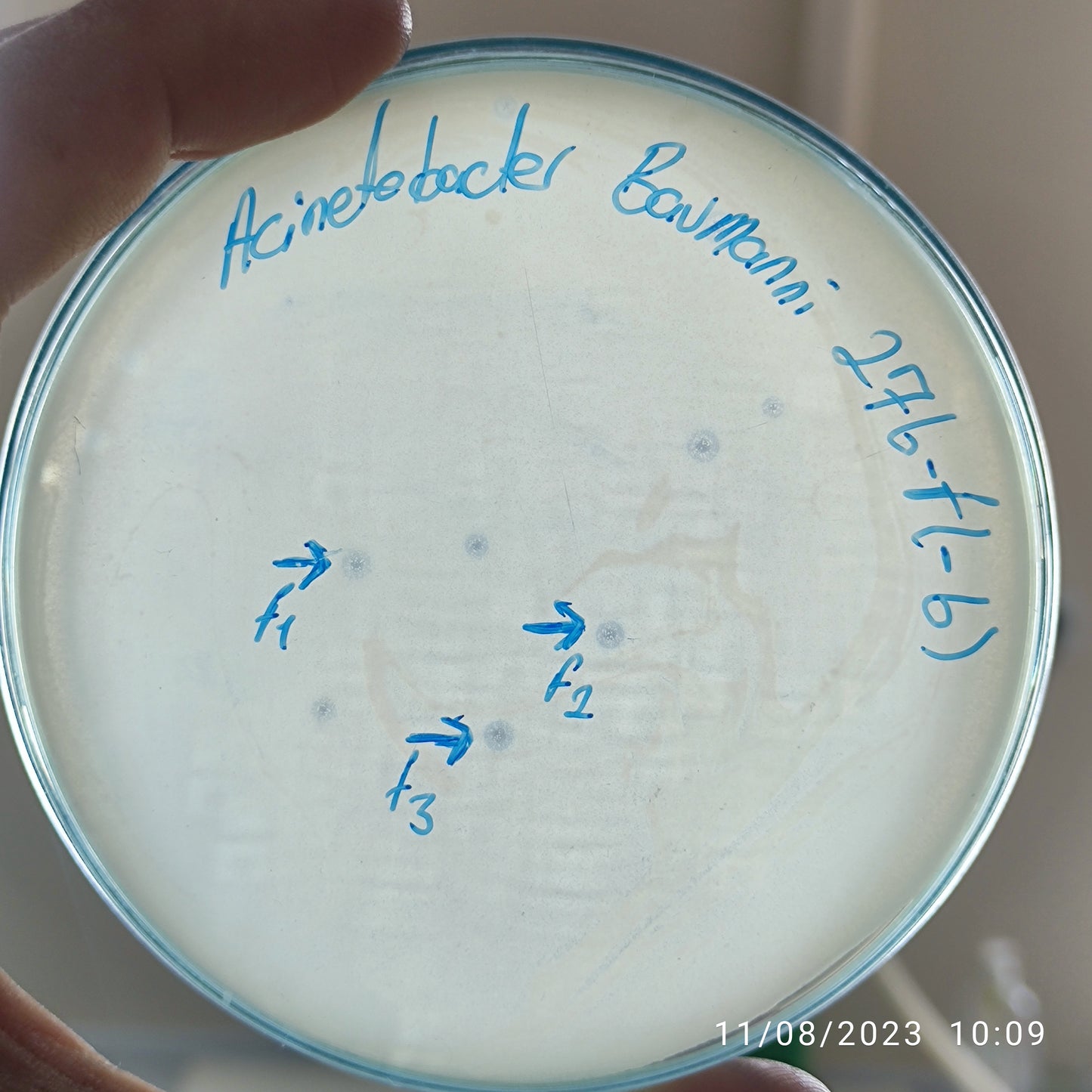 Acinetobacter baumannii bacteriophage 120276F