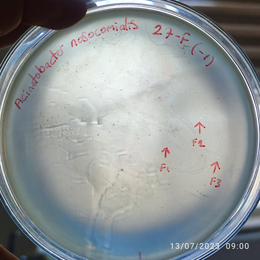 Acinetobacter nosocomialis bacteriophage 128027F