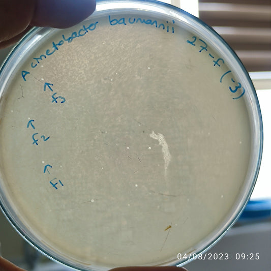 Acinetobacter baumannii bacteriophage 120027F