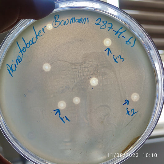 Acinetobacter baumannii bacteriophage 120287F