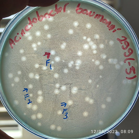 Acinetobacter baumannii bacteriophage 120299F