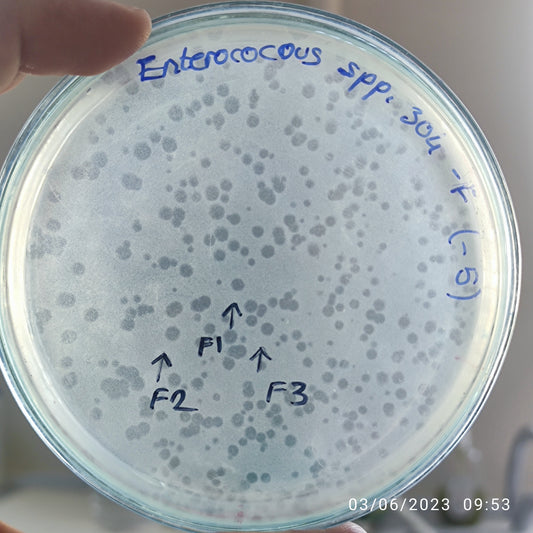 Enterococcus bacteriophage 110304F