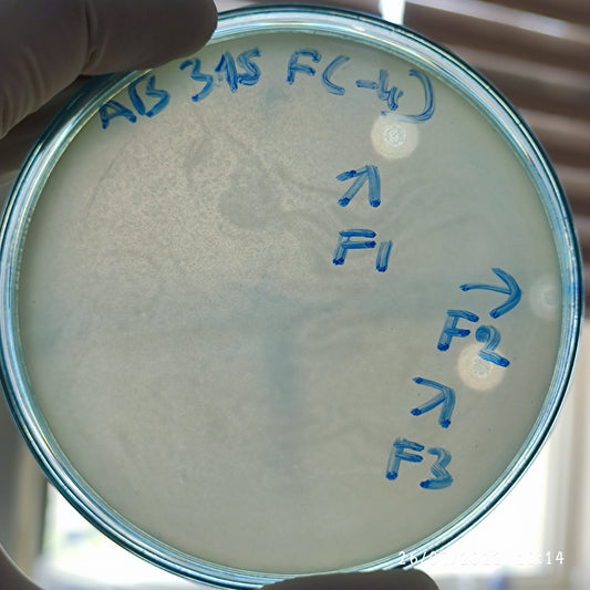 Acinetobacter baumannii bacteriophage 120315F
