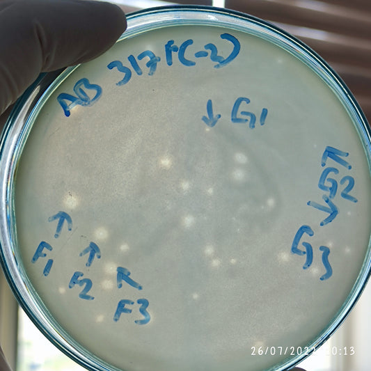 Acinetobacter baumannii bacteriophage 120317F