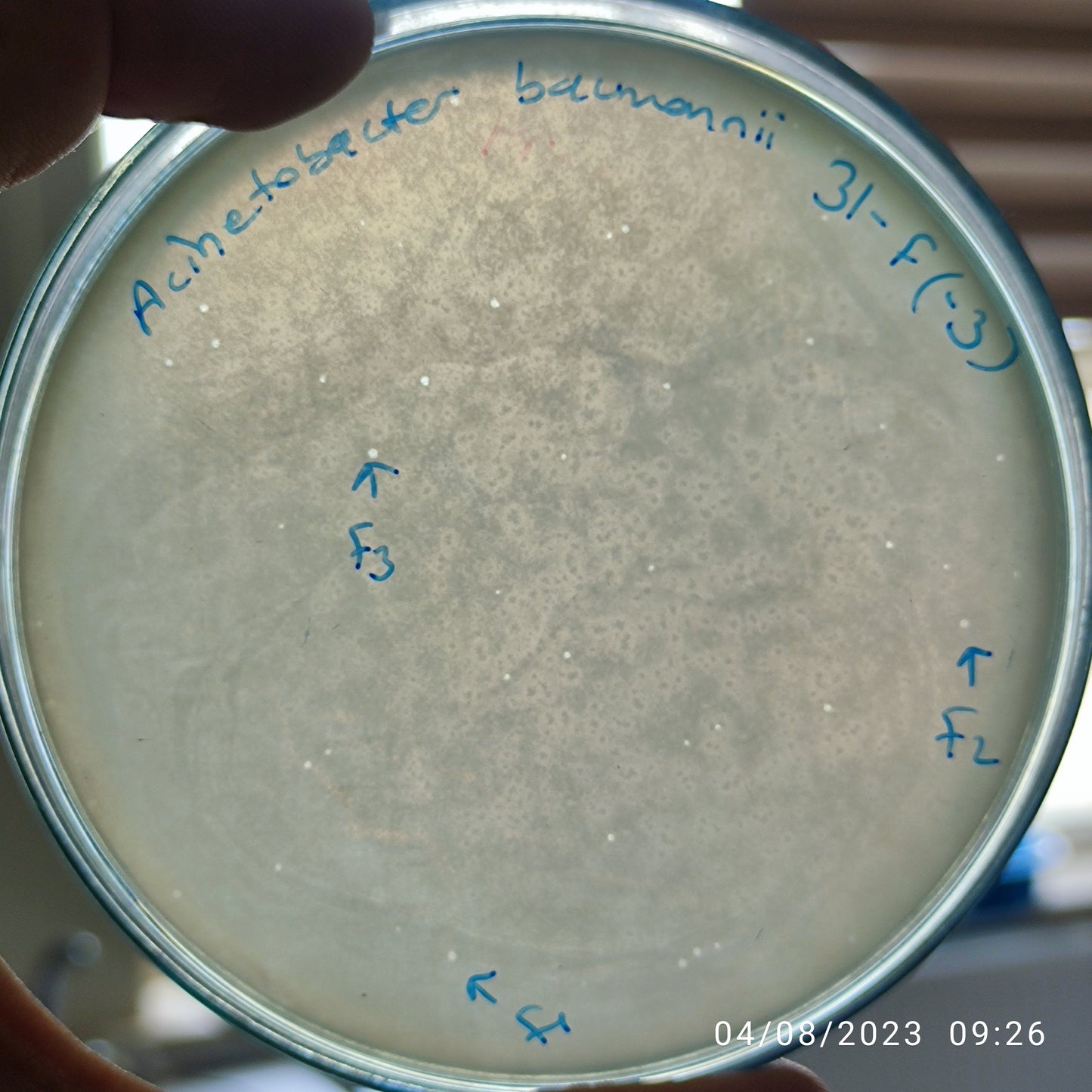 Acinetobacter baumannii bacteriophage 120031F