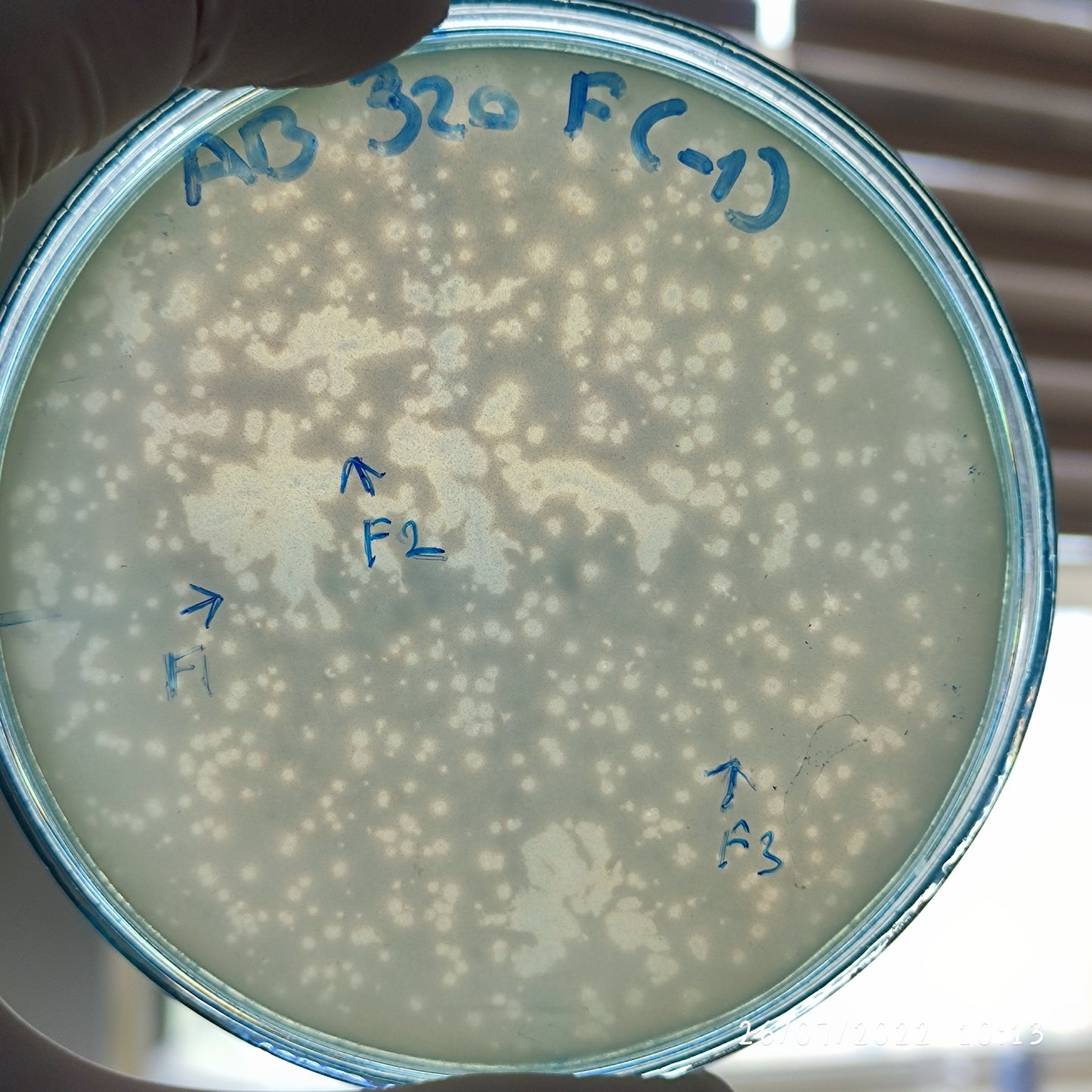 Acinetobacter baumannii bacteriophage 120320F