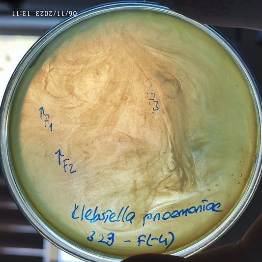 Klebsiella pneumoniae bacteriophage 180323F