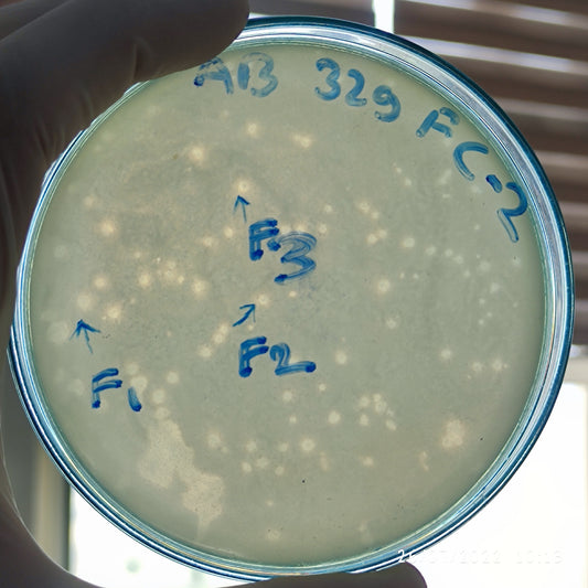 Acinetobacter baumannii bacteriophage 120329F