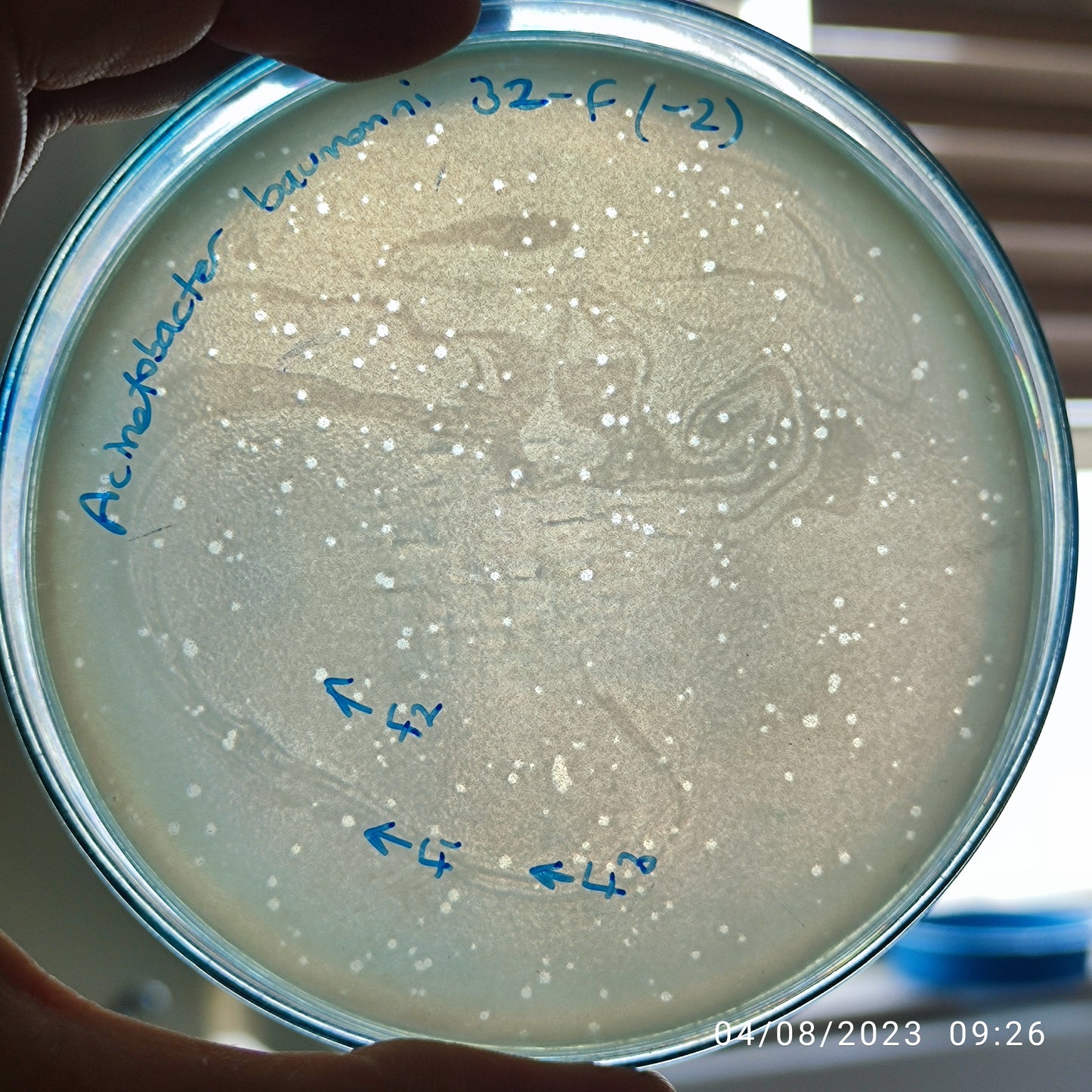 Acinetobacter baumannii bacteriophage 120032F