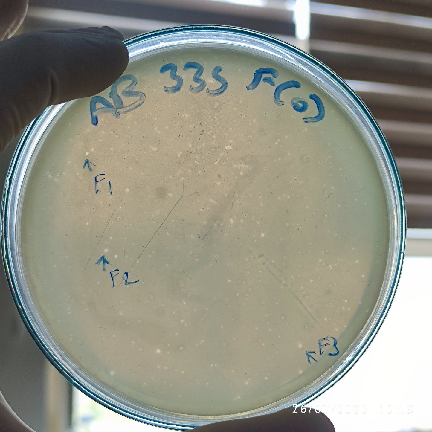 Acinetobacter baumannii bacteriophage 120335F