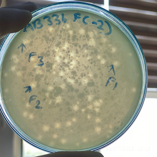 Acinetobacter baumannii bacteriophage 120336F