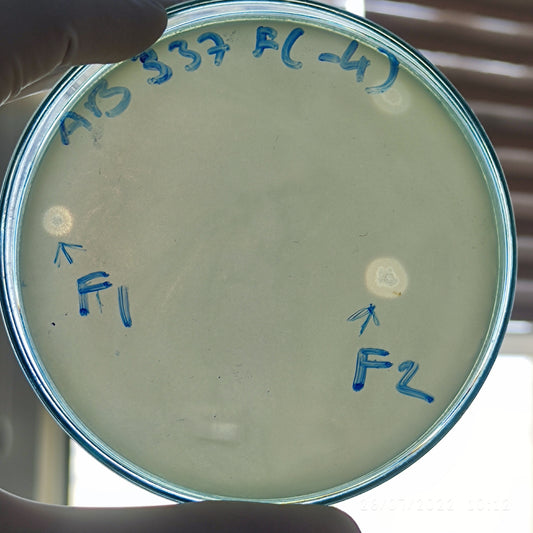 Acinetobacter baumannii bacteriophage 120337F