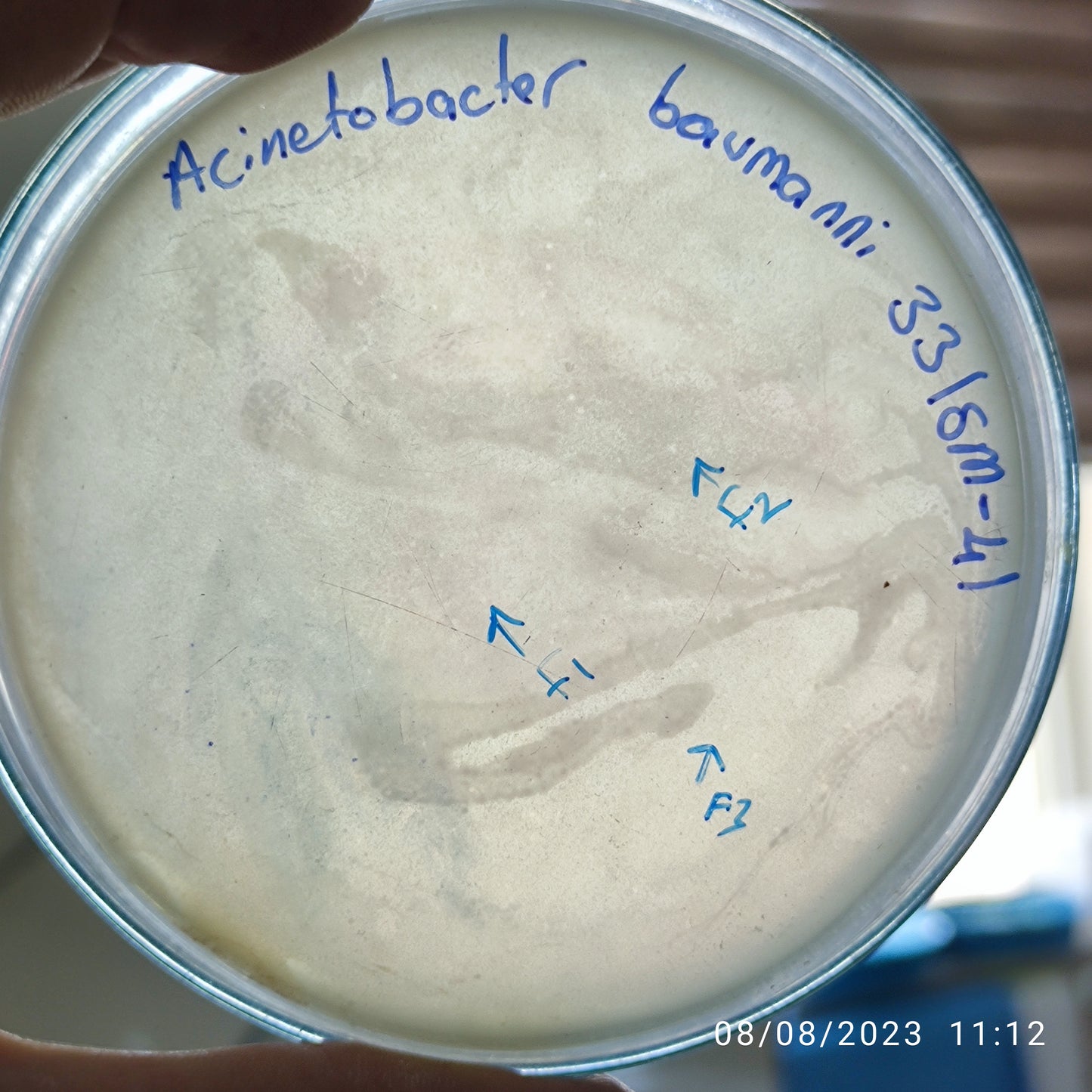 Acinetobacter baumannii bacteriophage 120033F